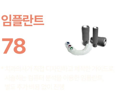 컴퓨터 분석을 이용한 임플란트