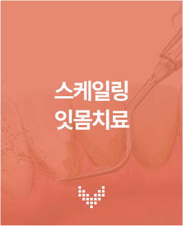 스케일링 잇몸치료