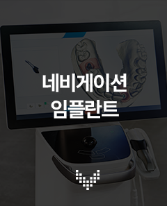 네비게이션 임플란트