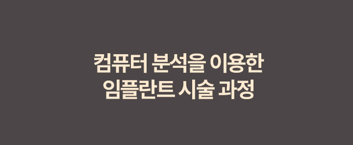 컴퓨터 분석을 이용한 임플란트 시술 과정