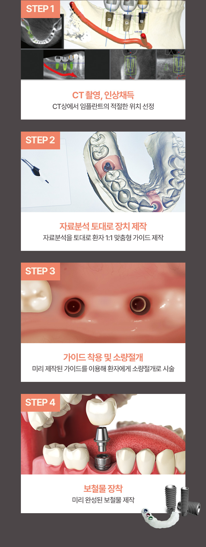 CT 촬영, 인상채득 | 자료분석 토대로 장치 제작 | 가이드 착용 및 소량절개 | 보철물 장착