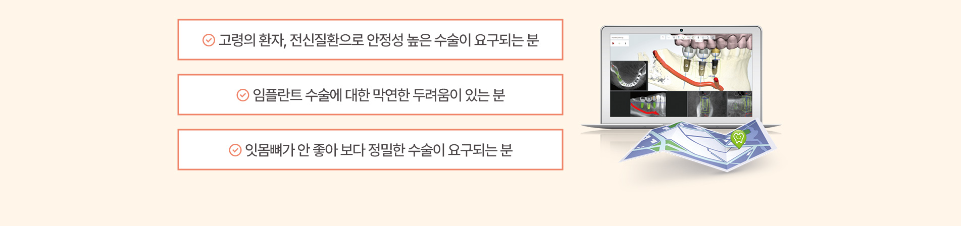 정확도와 안정성이 높은 컴퓨터 분석을 이용한 임플란트로 치아 건강을 되찾아보세요