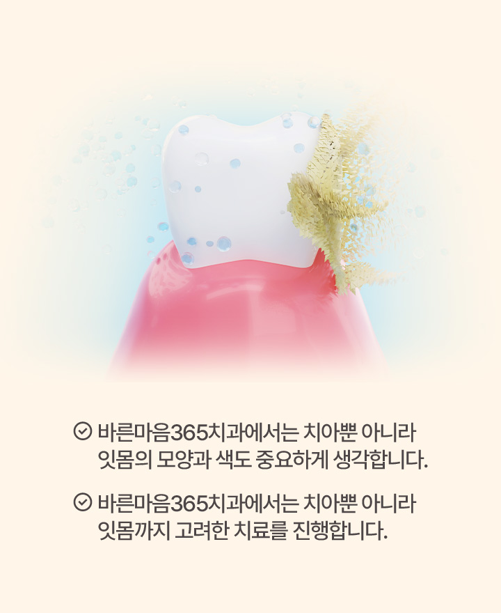 바른마음365치과에서는 치아뿐 아니라 잇몸의 모양과 색도 중요하게 생각합니다.