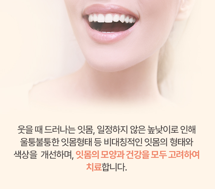 잇몸의 모양과 건강을 모두 고려하여 치료합니다.